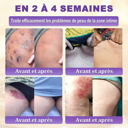 Fabriquée en France et expédiée directement 🍁 Crème réparatrice pour la peau à la biotine Purelora® (formule 10-en-1) — Dernier jour de promotion : -80 %.