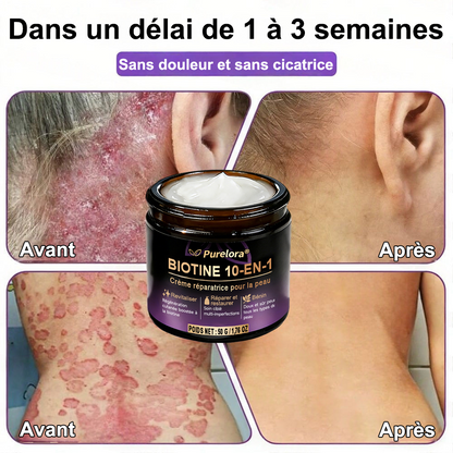 Fabriquée en France et expédiée directement 🍁 Crème réparatrice pour la peau à la biotine Purelora® (formule 10-en-1) — Dernier jour de promotion : -80 %.