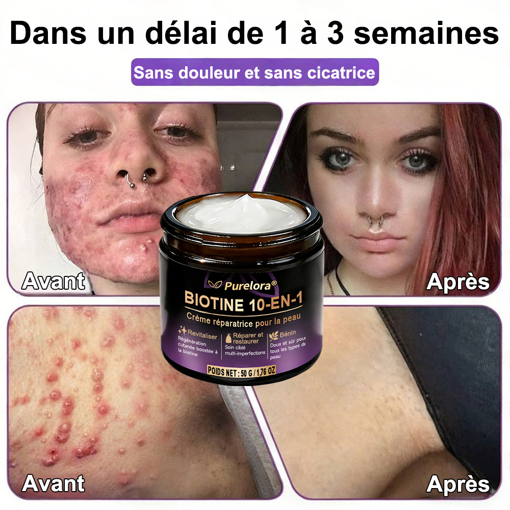 Fabriquée en France et expédiée directement 🍁 Crème réparatrice pour la peau à la biotine Purelora® (formule 10-en-1) — Dernier jour de promotion : -80 %.
