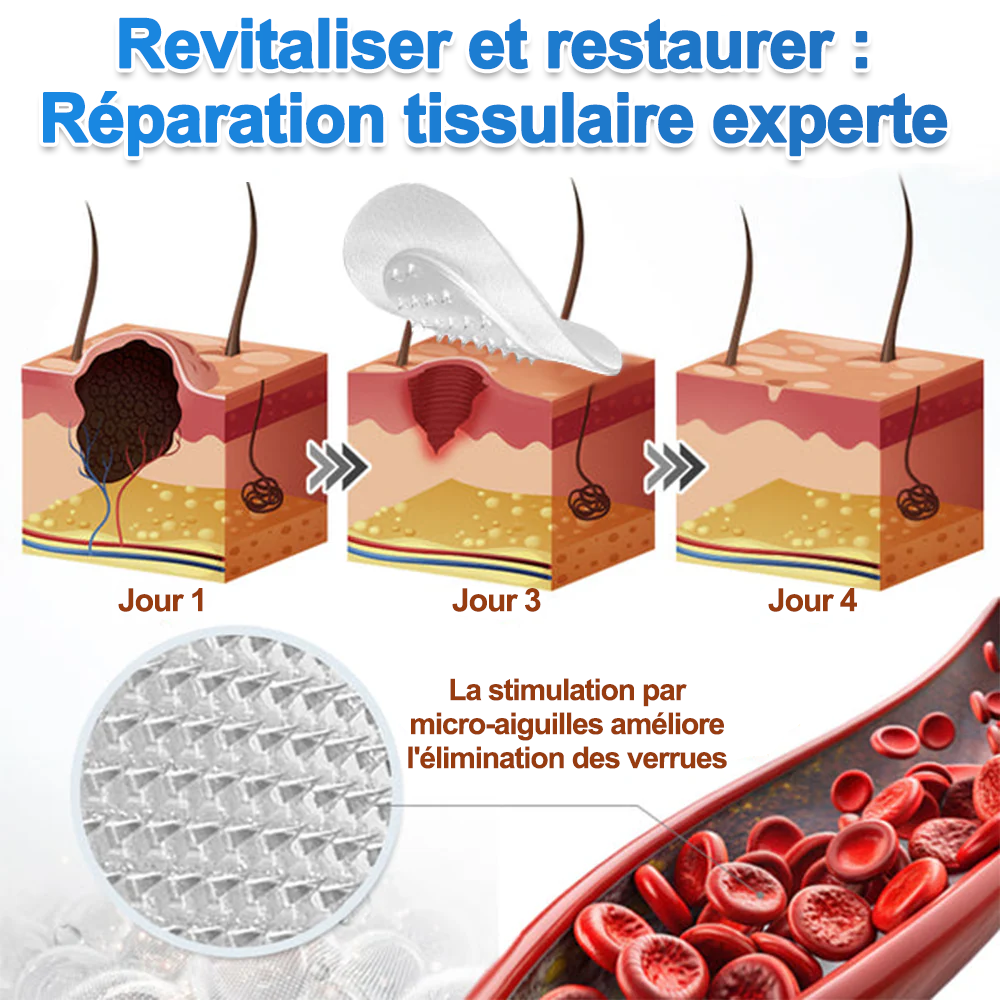✨Patch 2-en-1 Curalona® : Microneedle & Hydrocolloïde🍀 | Élimine les grains de beauté en relief, les verrues planes et les acrochordons | Aide à atténuer les rides, les cicatrices et les imperfections | Patch invisible adapté au visage et au corps