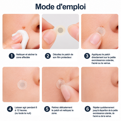 ✨Patch 2-en-1 Curalona® : Microneedle & Hydrocolloïde🍀 | Élimine les grains de beauté en relief, les verrues planes et les acrochordons | Aide à atténuer les rides, les cicatrices et les imperfections | Patch invisible adapté au visage et au corps