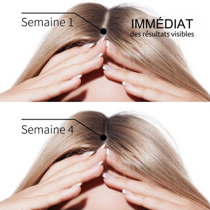 🌿👨‍⚕️ Boutique officielle française | 🔥 Shampoing et après-shampoing 2-en-1 PURELORA® à l'oignon et au romarin — Enrichi d'un complexe actif stimulant la croissance capillaire (concentration x15) pour des cheveux plus épais, plus denses et plus forts.