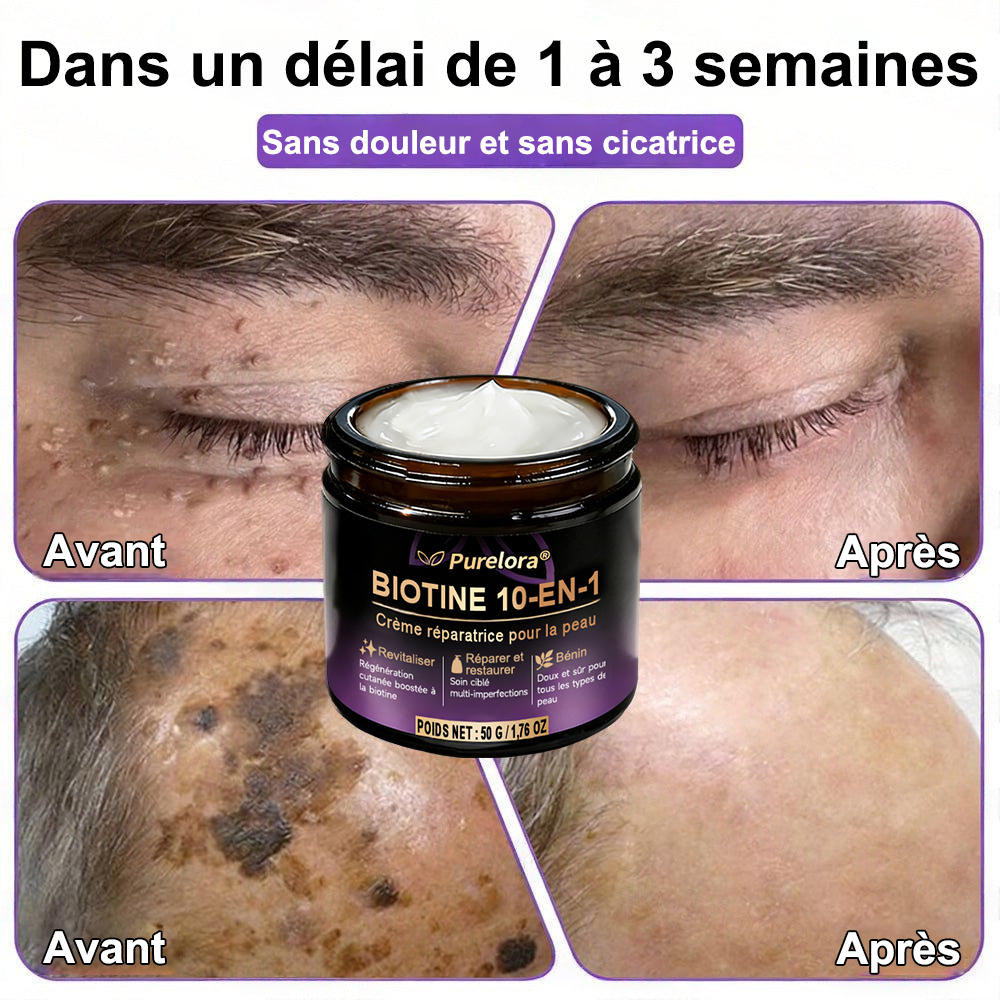Fabriquée en France et expédiée directement 🍁 Crème réparatrice pour la peau à la biotine Purelora® (formule 10-en-1) — Dernier jour de promotion : -80 %.