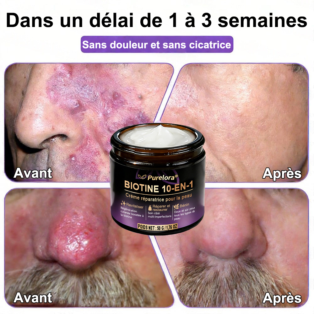 Fabriquée en France et expédiée directement 🍁 Crème réparatrice pour la peau à la biotine Purelora® (formule 10-en-1) — Dernier jour de promotion : -80 %.