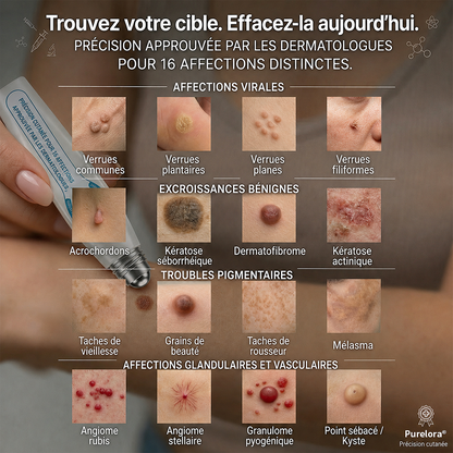 𝐁𝐨𝐮𝐭𝐢𝐪𝐮𝐞 𝐨𝐟𝐟𝐢𝐜𝐢𝐞𝐥𝐥𝐞 𝐝𝐞 𝐥𝐚 𝐦𝐚𝐫𝐪𝐮𝐞 |✅💎Purelora® Éliminateur de taches et d’excroissances cutanées en 7 jours (Roller sans douleur, sans cicatrice)