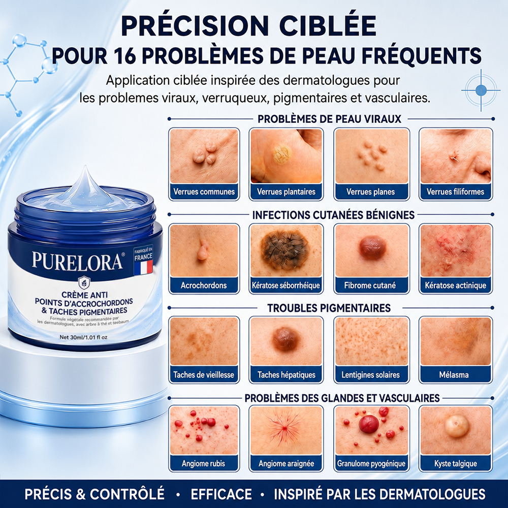 Crème PURELORA® pour l'élimination des acrochordons et des imperfections en 7 jours (formule indolore – sans cicatrice) 🌹🌹
