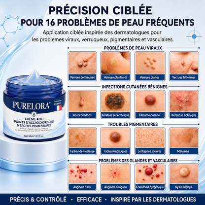 Crème PURELORA® pour l'élimination des acrochordons et des imperfections en 7 jours (formule indolore – sans cicatrice) 🌹🌹