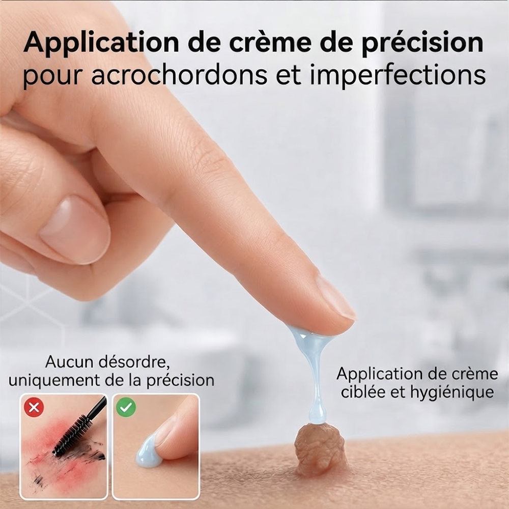 Crème PURELORA® pour l'élimination des acrochordons et des imperfections en 7 jours (formule indolore – sans cicatrice) 🌹🌹