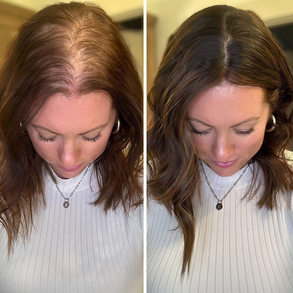 🌿👨‍⚕️ Boutique officielle française | 🔥 Shampoing et après-shampoing 2-en-1 PURELORA® à l'oignon et au romarin — Enrichi d'un complexe actif stimulant la croissance capillaire (concentration x15) pour des cheveux plus épais, plus denses et plus forts.